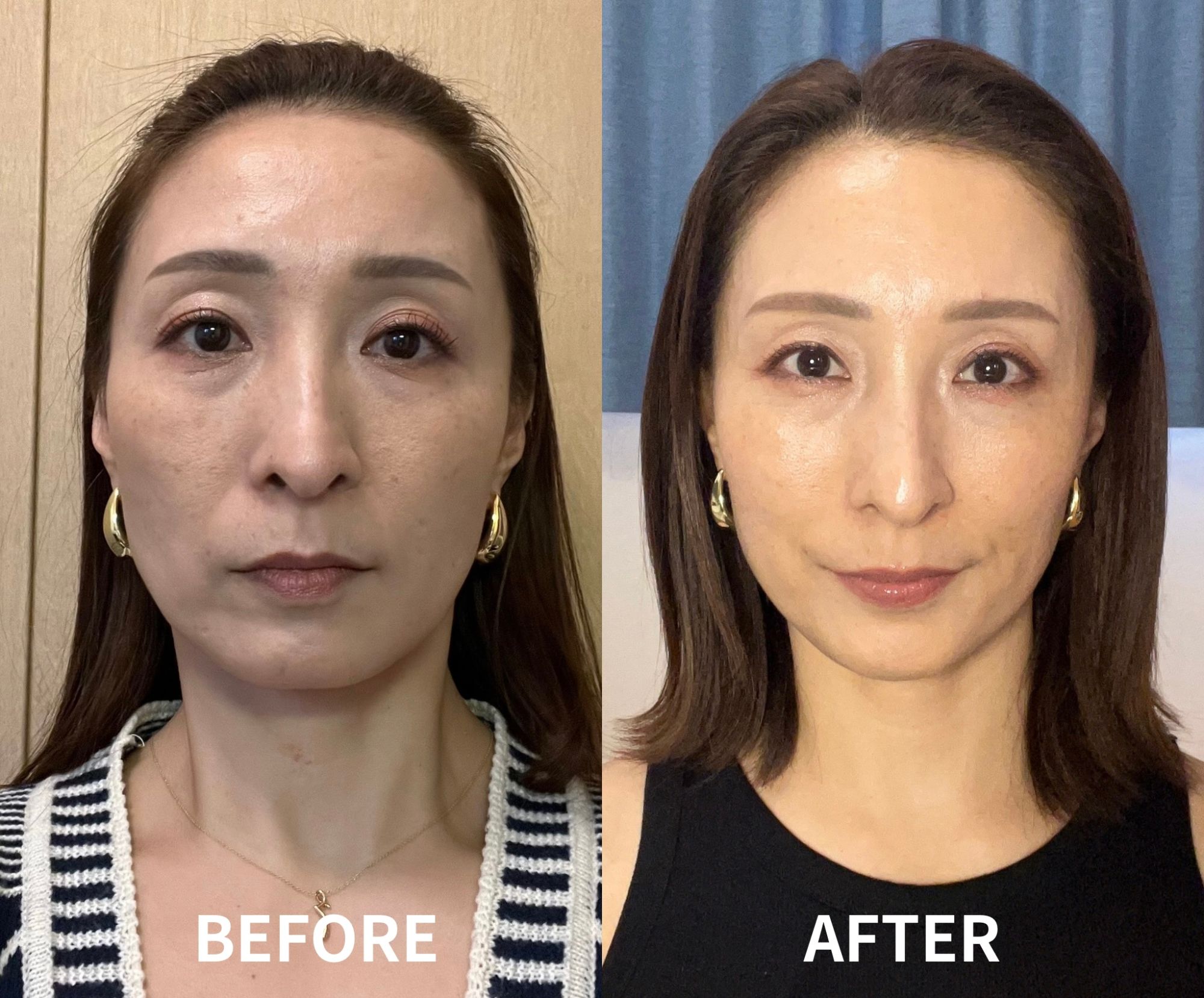 宇野理加本人のビフォーアフター（3ヶ月の変化）